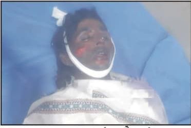 Poured petrol and set it on fire